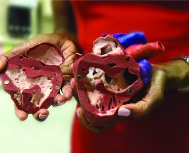 A 3D printed model of a human heart